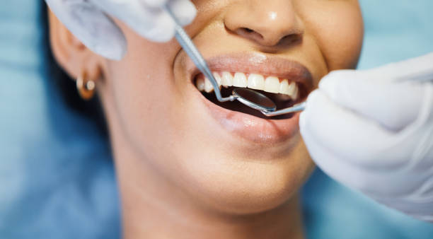 Best Emergency Dental Care for Sports Injuries in Redland, AL