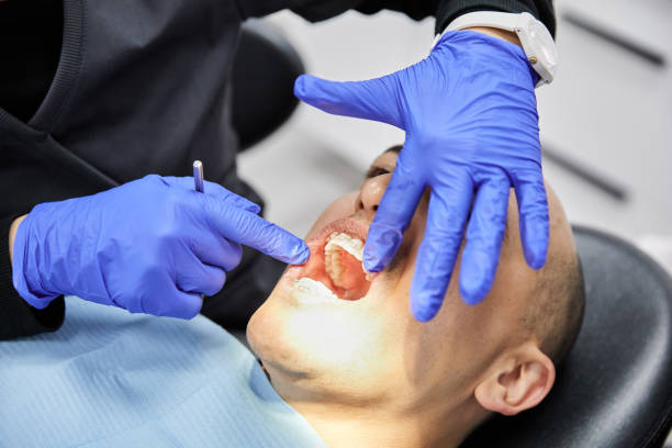 Best Knocked-Out Tooth (Avulsed Tooth) Treatment in Redland, AL