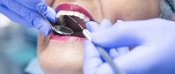 Best Dental Abscess Treatment in Redland, AL
